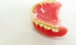 Bright Orange Plaque on Teeth: Causes, Prevention, and Treatment